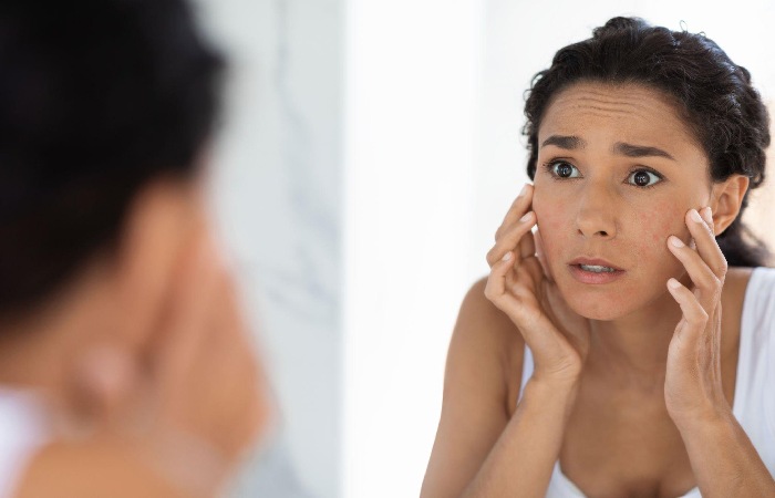 pores and skin